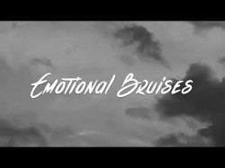 Madison Beer - Emotional Bruises